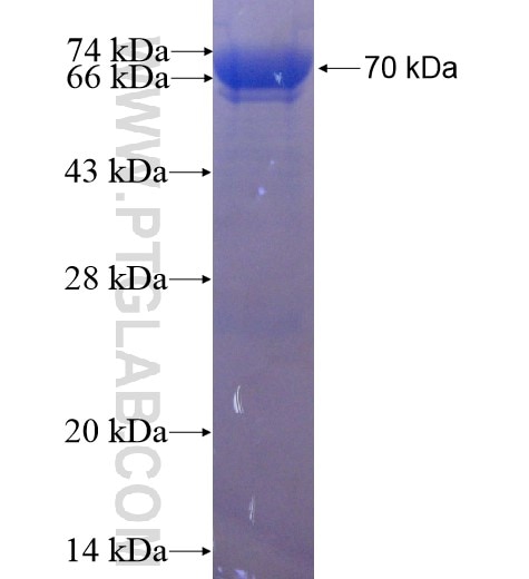CTBP1 fusion protein Ag1425 SDS-PAGE