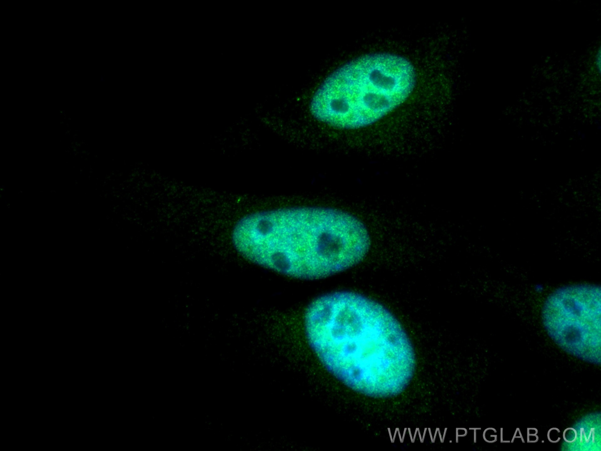 Immunofluorescence (IF) / fluorescent staining of HeLa cells using CTBP2 Polyclonal antibody (10346-1-AP)