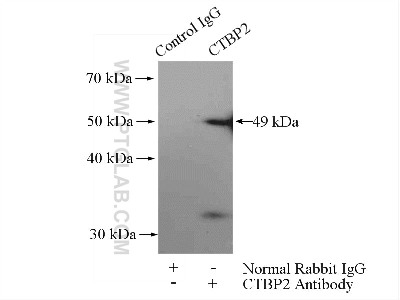 Immunoprecipitation (IP) experiment of mouse heart tissue using CTBP2 Polyclonal antibody (10346-1-AP)