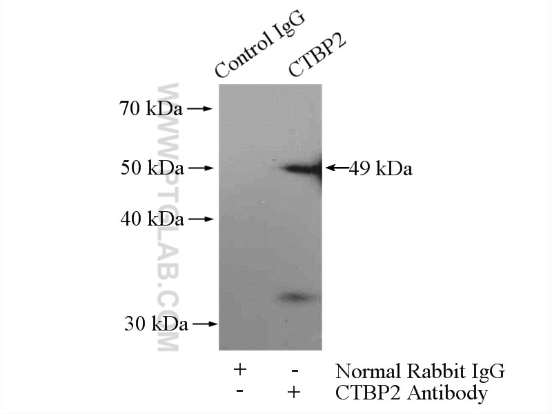 IP experiment of mouse heart using 10346-1-AP