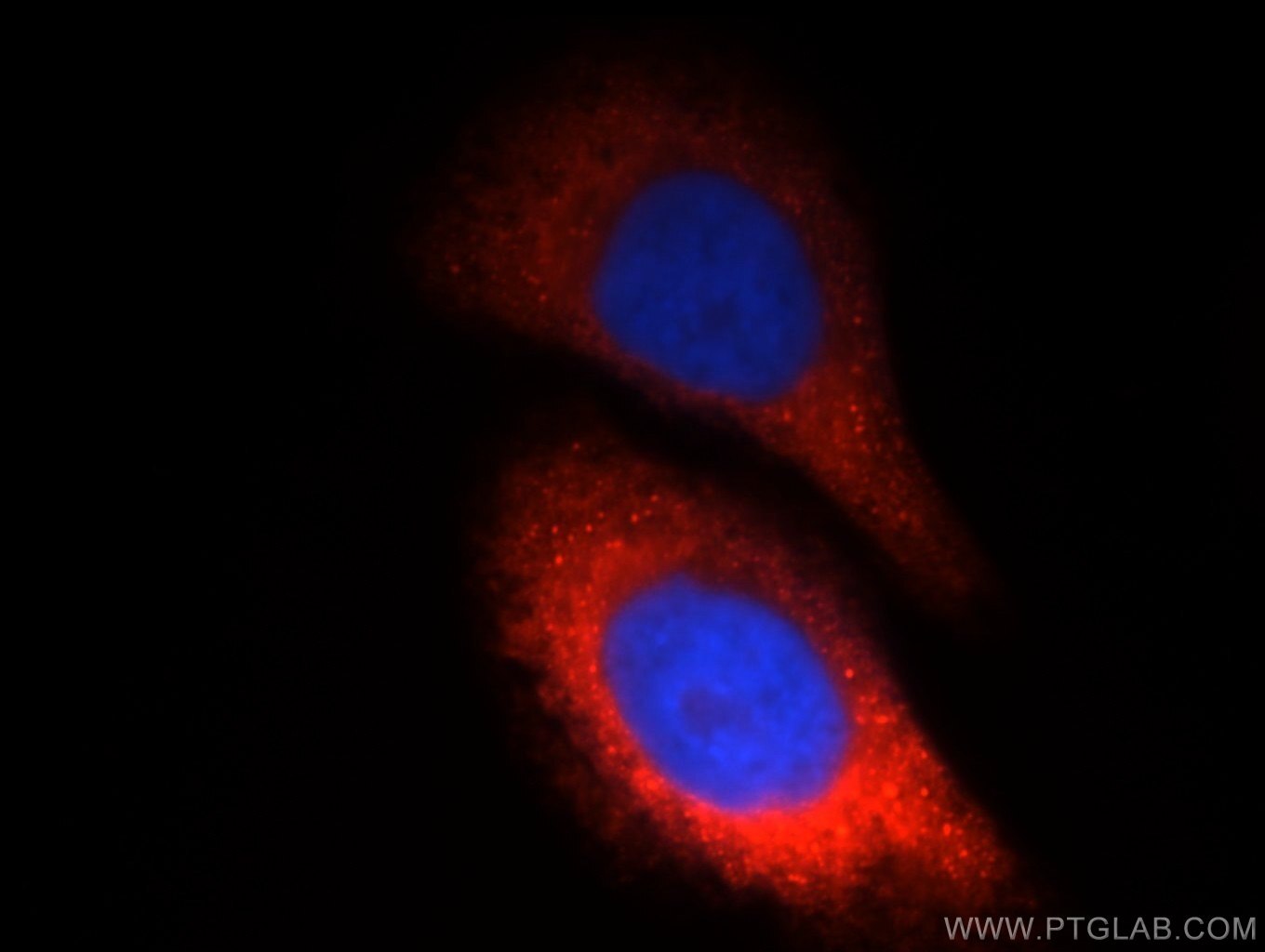 Immunofluorescence (IF) / fluorescent staining of HepG2 cells using CTBS Polyclonal antibody (12599-1-AP)