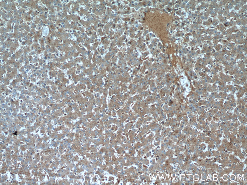 Immunohistochemistry (IHC) staining of human liver tissue using CTBS Polyclonal antibody (12599-1-AP)