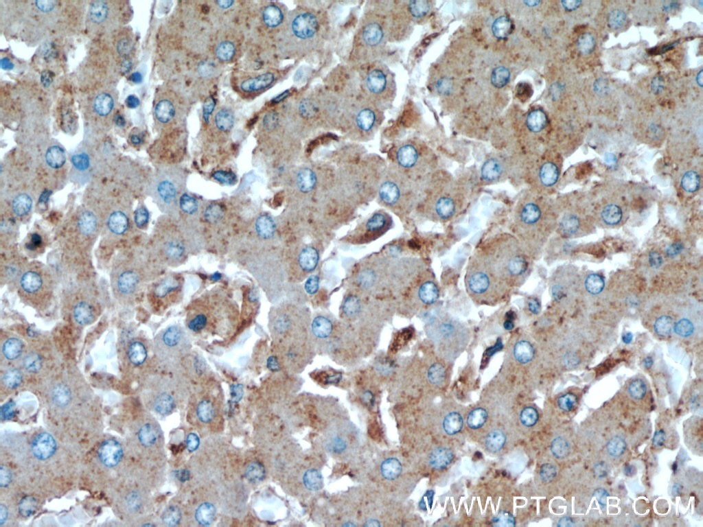 IHC staining of human liver using 12599-1-AP