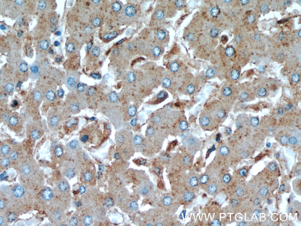 Immunohistochemistry (IHC) staining of human liver tissue using CTBS Polyclonal antibody (12599-1-AP)