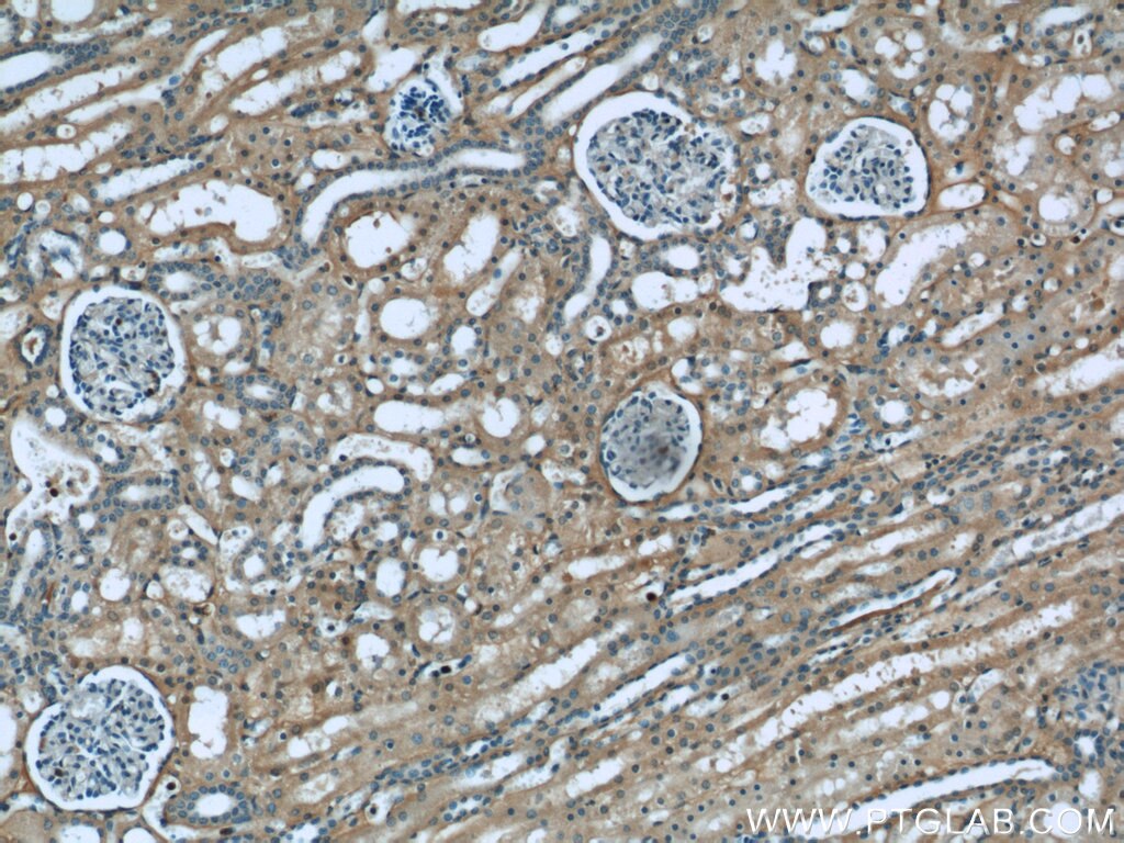 Immunohistochemistry (IHC) staining of human kidney tissue using CTBS Polyclonal antibody (12599-1-AP)
