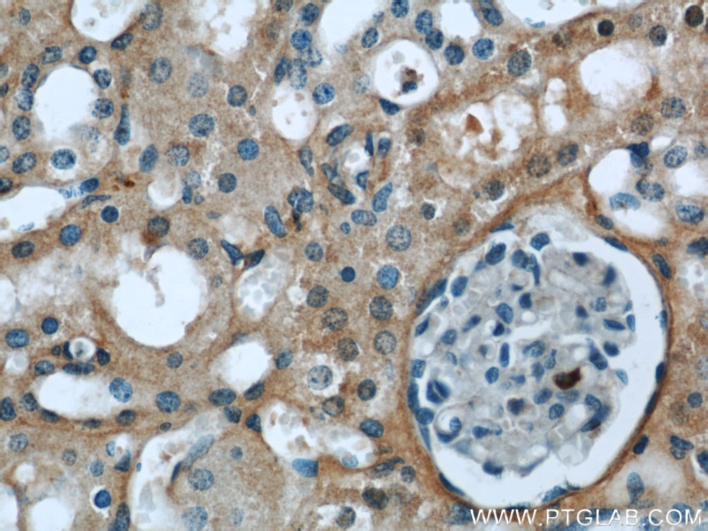 Immunohistochemistry (IHC) staining of human kidney tissue using CTBS Polyclonal antibody (12599-1-AP)