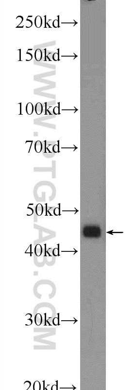 Western Blot (WB) analysis of HeLa cells using CTBS Polyclonal antibody (12599-1-AP)