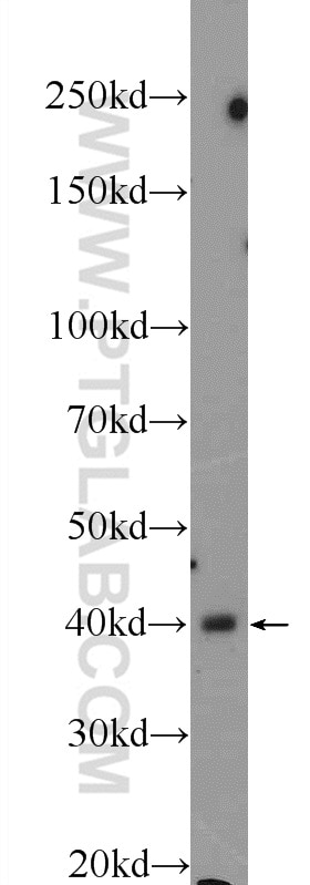 Western Blot (WB) analysis of SMMC-7721 cells using CTBS Polyclonal antibody (12599-1-AP)