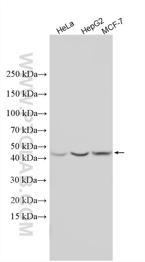 Western Blot (WB) analysis of various lysates using CTBS Polyclonal antibody (12599-1-AP)