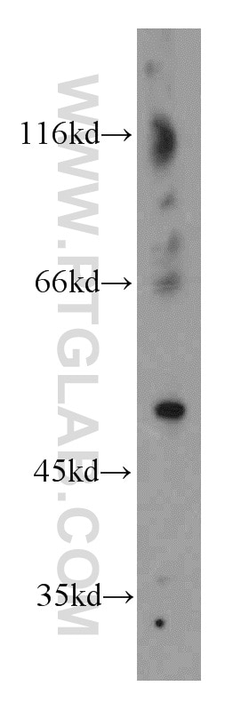Western Blot (WB) analysis of mouse colon tissue using CTBS Polyclonal antibody (12599-1-AP)