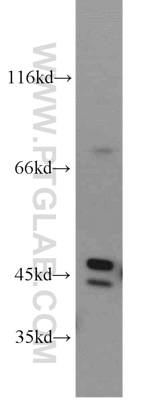 Western Blot (WB) analysis of HeLa cells using CTBS Polyclonal antibody (12599-1-AP)