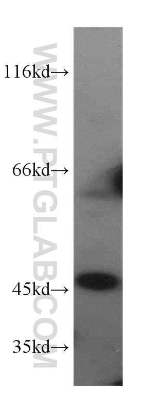 Western Blot (WB) analysis of HepG2 cells using CTBS Polyclonal antibody (12599-1-AP)