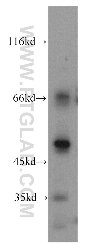 Western Blot (WB) analysis of mouse colon tissue using CTBS Polyclonal antibody (12599-1-AP)