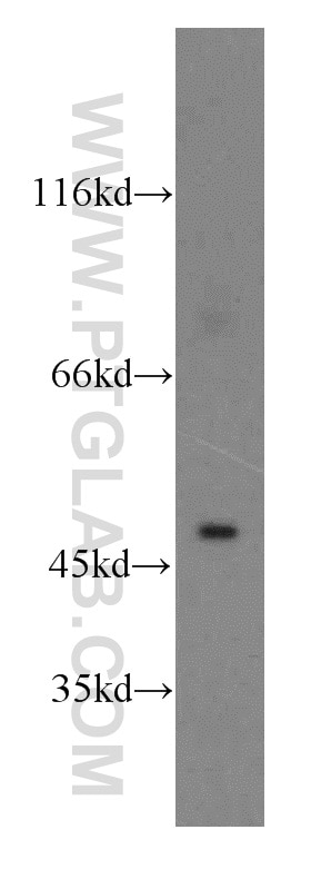 Western Blot (WB) analysis of MCF-7 cells using CTBS Polyclonal antibody (12599-1-AP)
