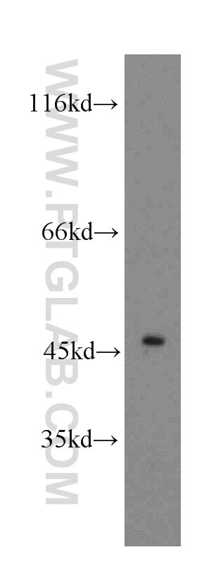 Western Blot (WB) analysis of HepG2 cells using CTBS Polyclonal antibody (12599-1-AP)
