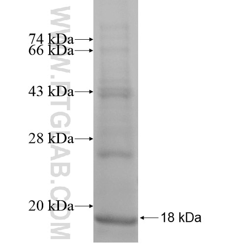 CTBS fusion protein Ag14603 SDS-PAGE
