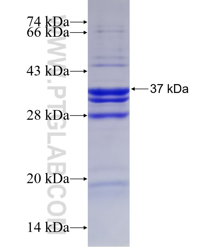 CTBS fusion protein Ag3228 SDS-PAGE