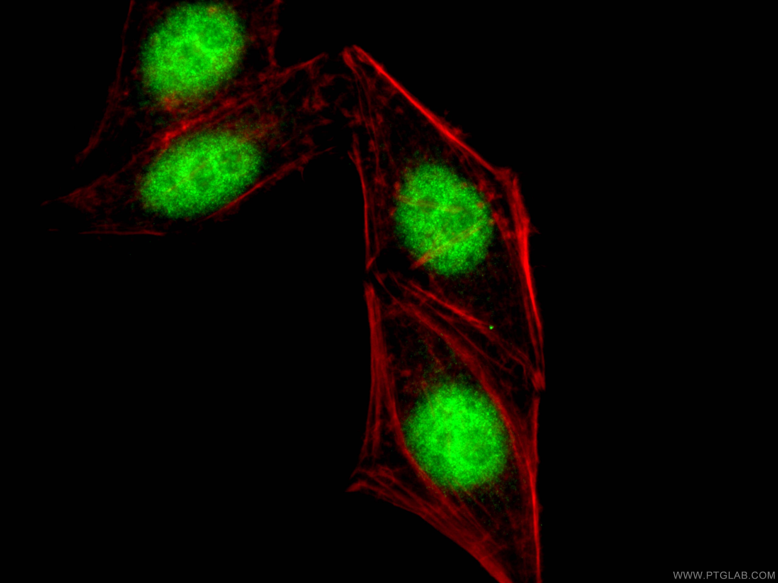 Immunofluorescence (IF) / fluorescent staining of HepG2 cells using CTCF Polyclonal antibody (10915-1-AP)