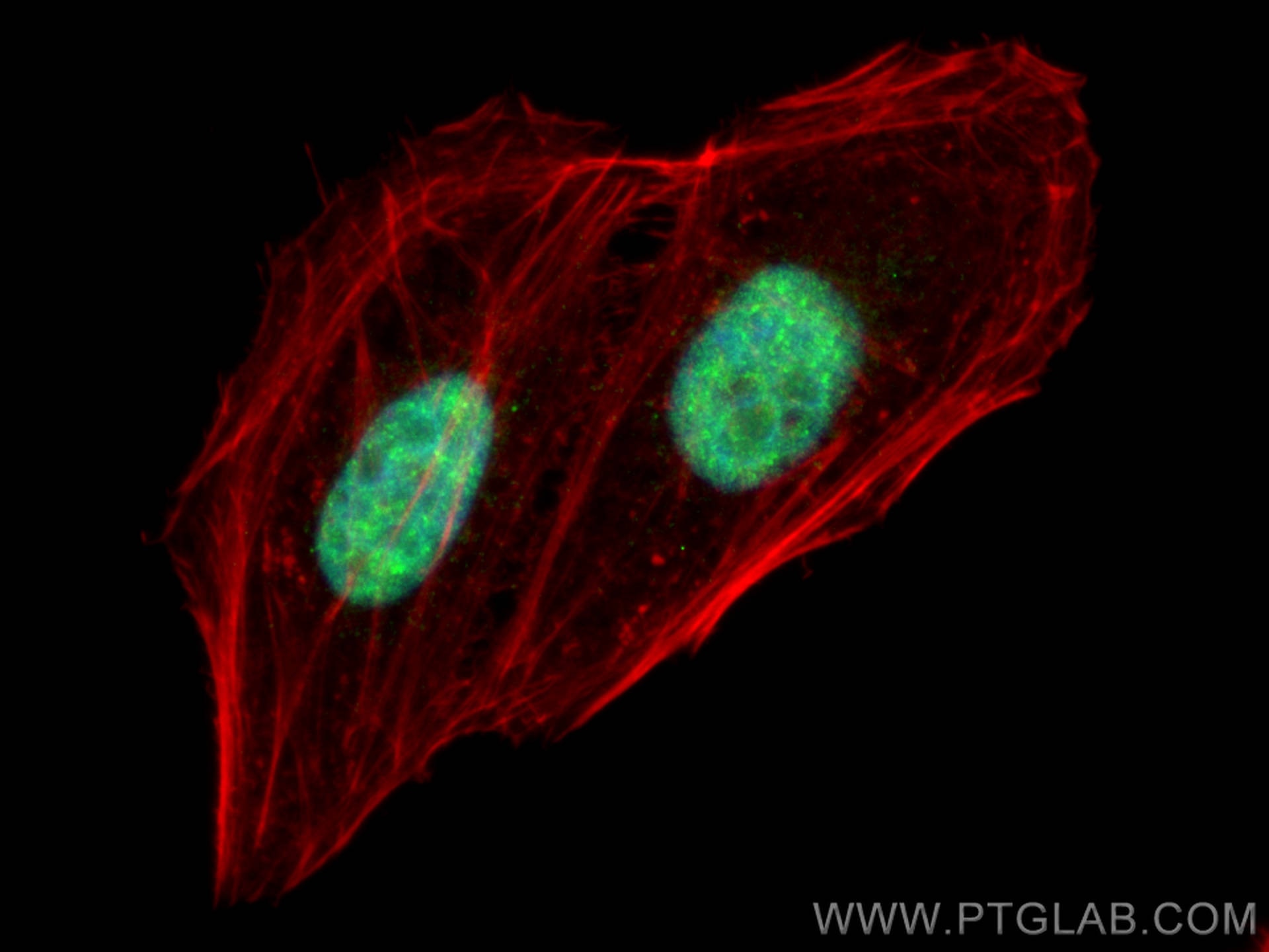 Immunofluorescence (IF) / fluorescent staining of HepG2 cells using CTCF Polyclonal antibody (10915-1-AP)