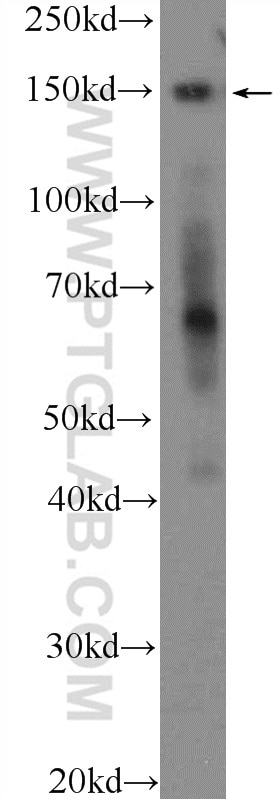 Western Blot (WB) analysis of HEK-293T cells using CTCF Polyclonal antibody (10915-1-AP)