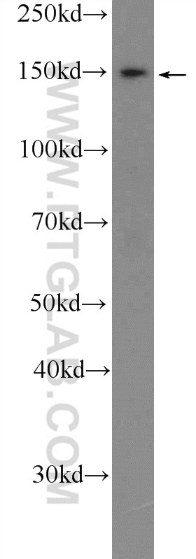 Western Blot (WB) analysis of 4T1 cells using CTCF Polyclonal antibody (10915-1-AP)