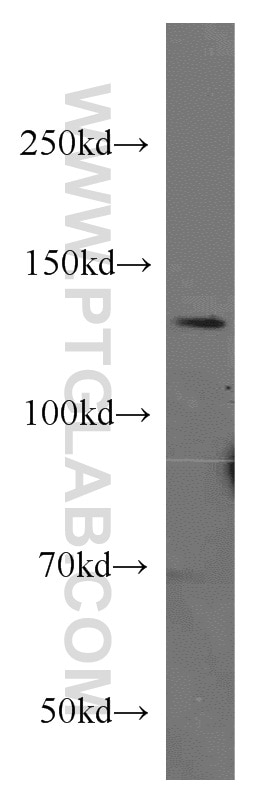 Western Blot (WB) analysis of human brain tissue using CTCF Polyclonal antibody (10915-1-AP)