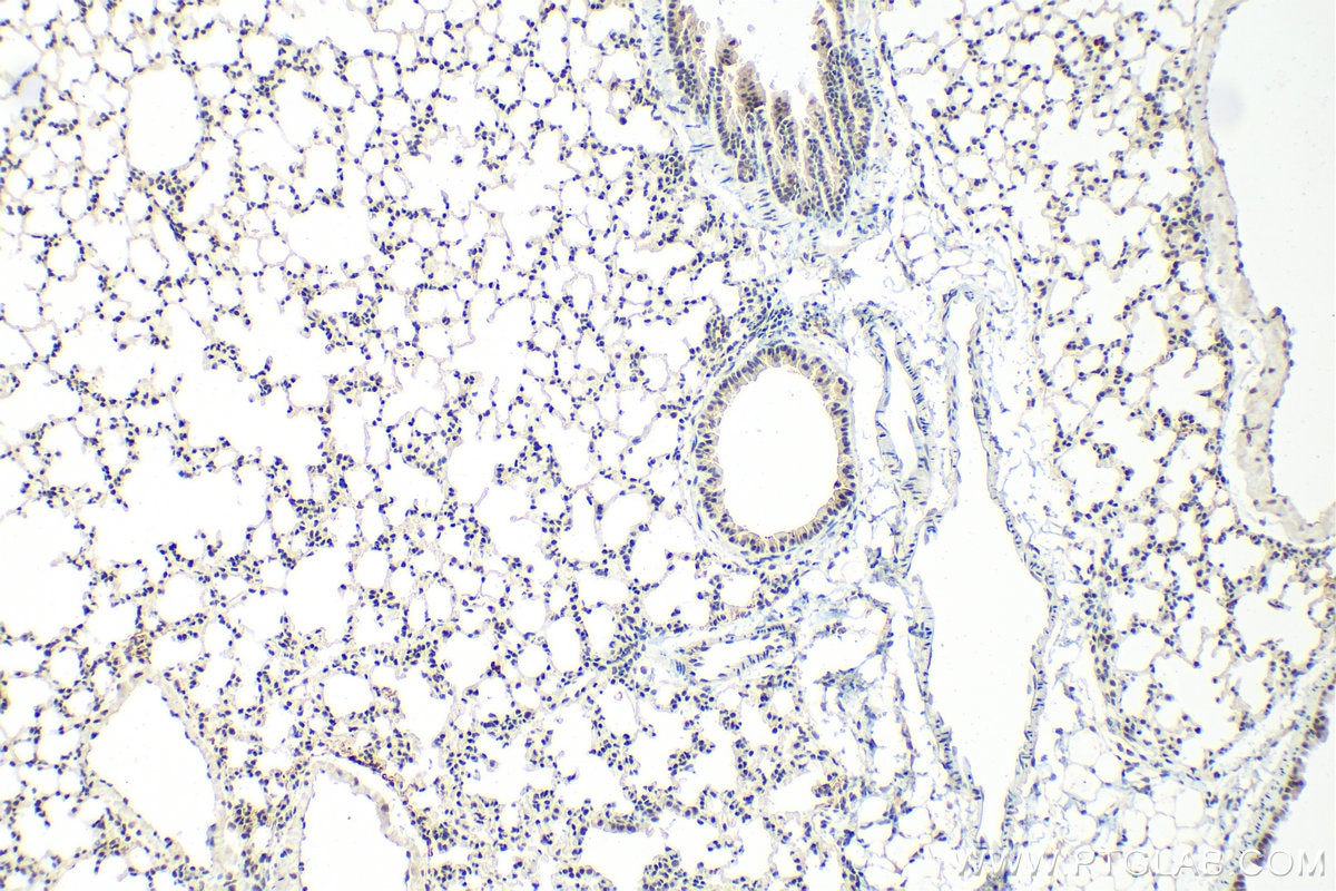 Immunohistochemistry (IHC) staining of mouse lung tissue using CTCF Polyclonal antibody (30428-1-AP)