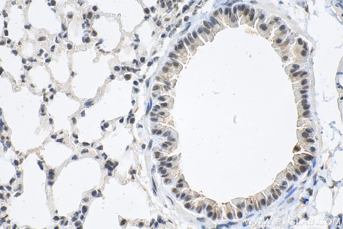 Immunohistochemistry (IHC) staining of mouse lung tissue using CTCF Polyclonal antibody (30428-1-AP)