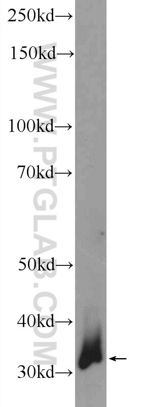 Western Blot (WB) analysis of mouse liver tissue using CTDSP1 Polyclonal antibody (10952-1-AP)