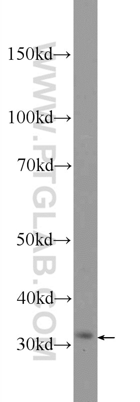 Western Blot (WB) analysis of mouse heart tissue using CTDSP1 Polyclonal antibody (10952-1-AP)