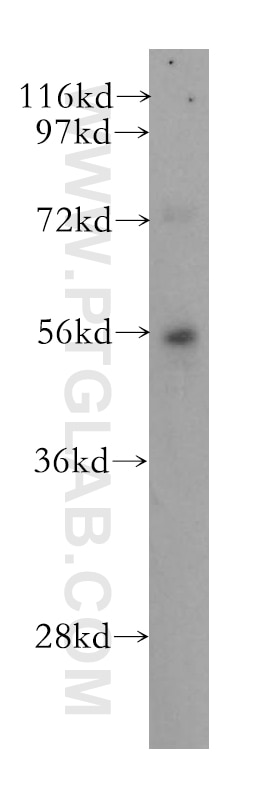 CTDSP1