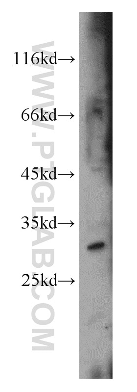 Western Blot (WB) analysis of HepG2 cells using CTDSP2 Polyclonal antibody (11116-1-AP)