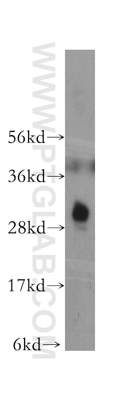 Western Blot (WB) analysis of K-562 cells using CTDSP2 Polyclonal antibody (11116-1-AP)