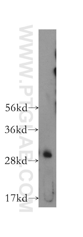 Western Blot (WB) analysis of human kidney tissue using CTDSP2 Polyclonal antibody (11116-1-AP)