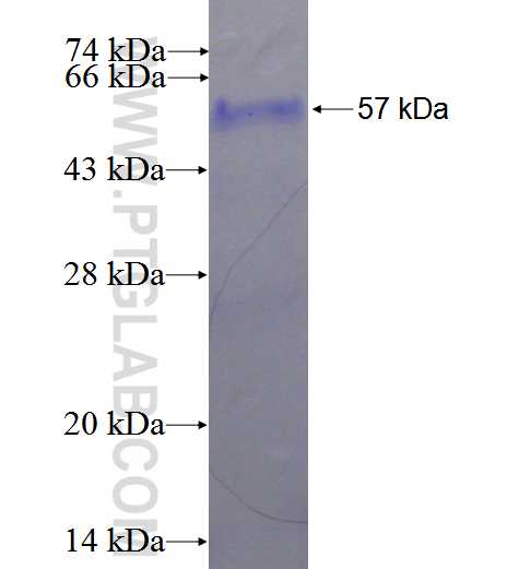 CTDSP2 fusion protein Ag1601 SDS-PAGE