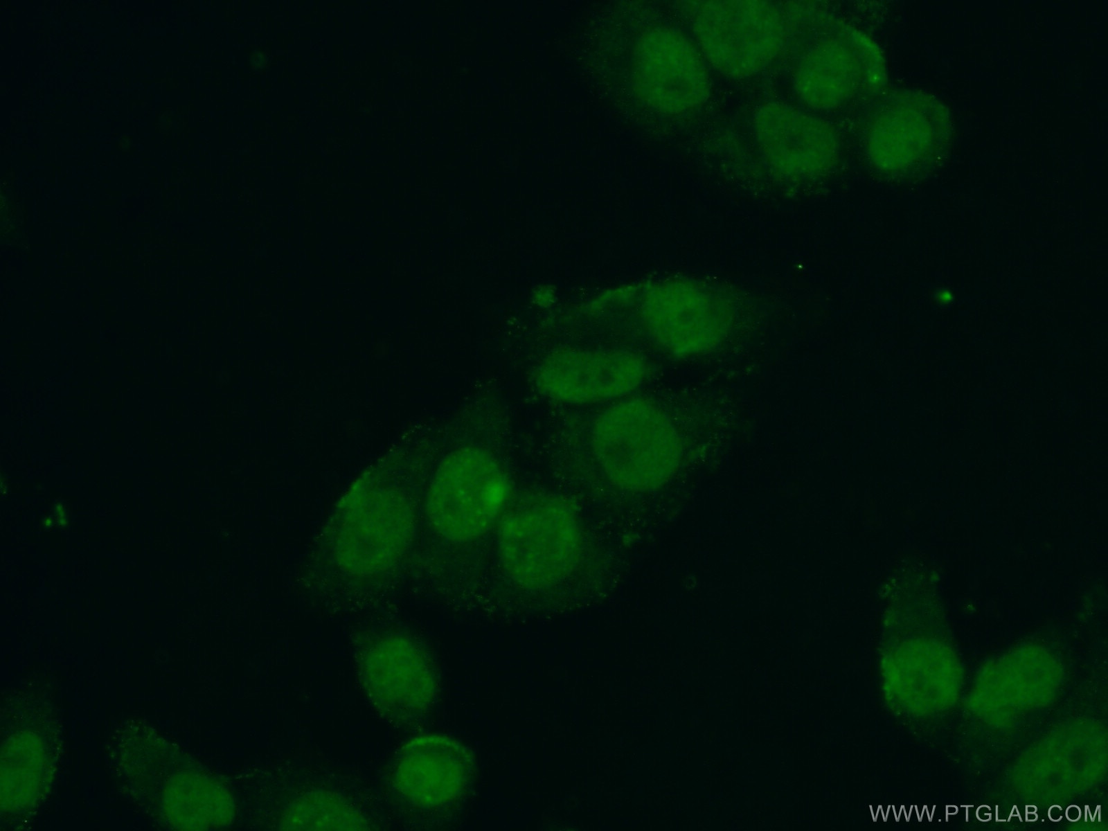Immunofluorescence (IF) / fluorescent staining of HeLa cells using CTDSPL2 Polyclonal antibody (17532-1-AP)