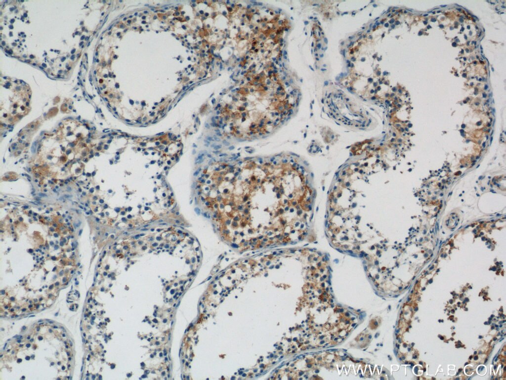 Immunohistochemistry (IHC) staining of human testis tissue using CTDSPL2 Polyclonal antibody (17532-1-AP)