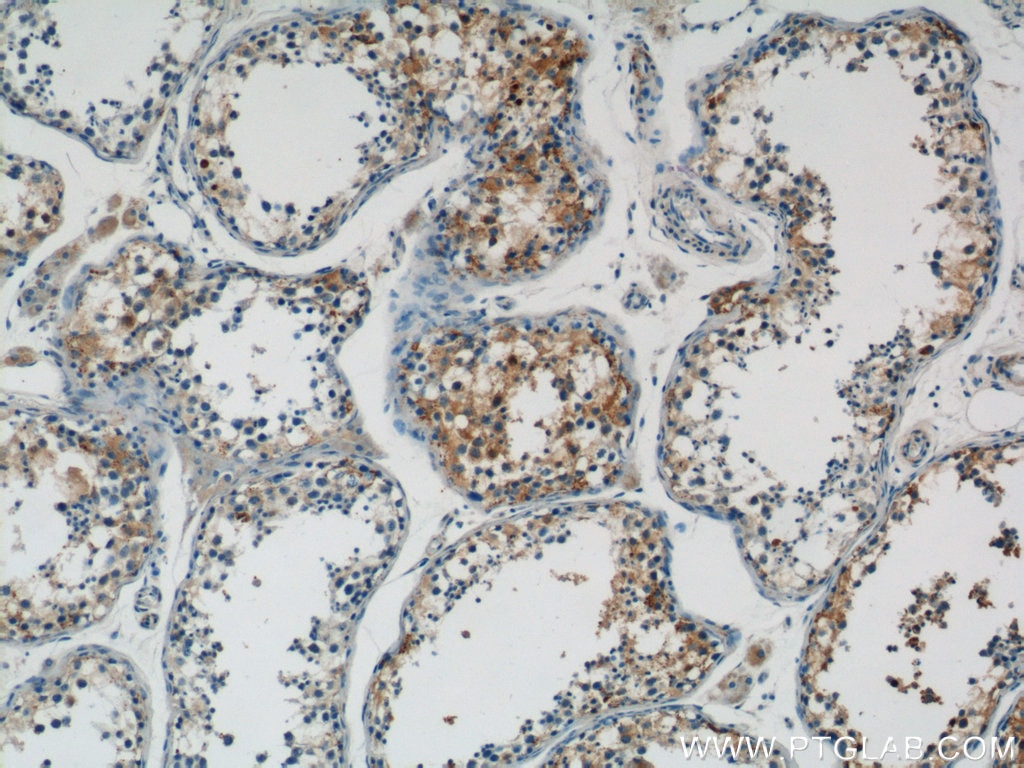 IHC staining of human testis using 17532-1-AP