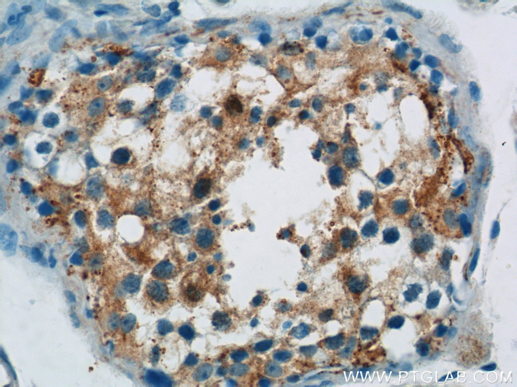 Immunohistochemistry (IHC) staining of human testis tissue using CTDSPL2 Polyclonal antibody (17532-1-AP)