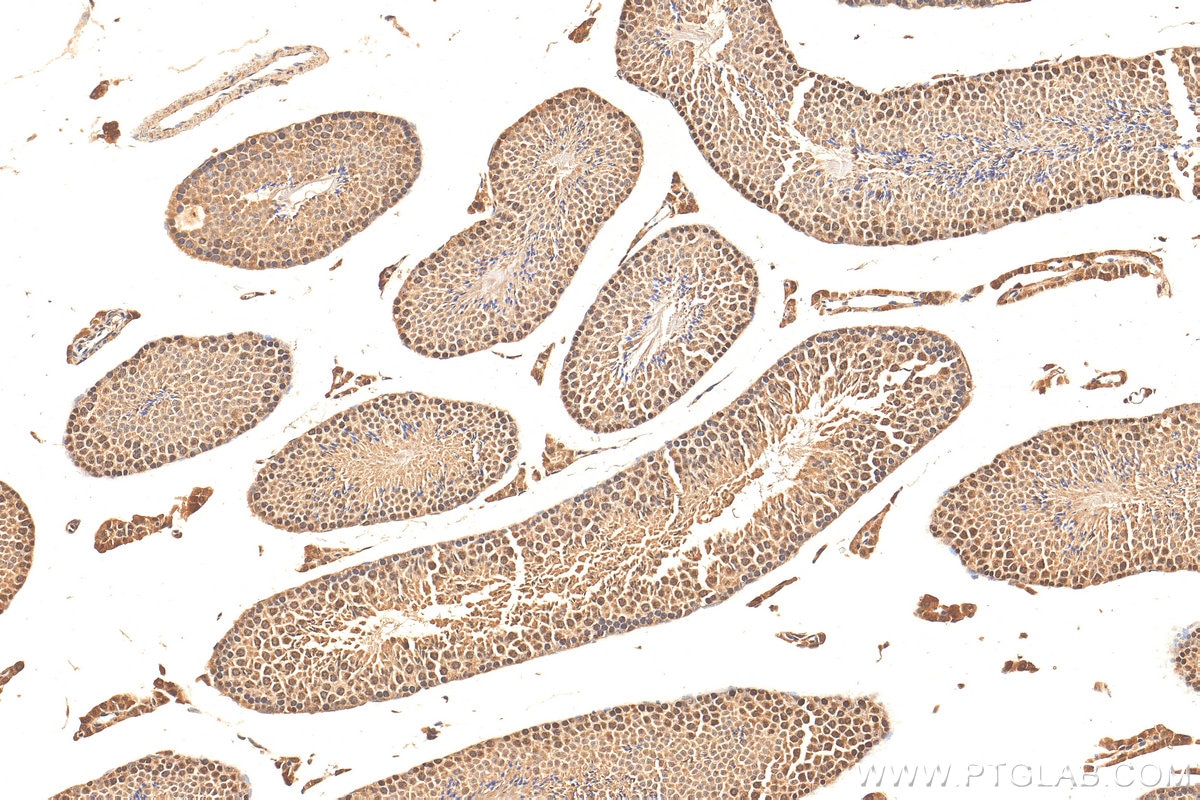 Immunohistochemistry (IHC) staining of mouse testis tissue using CTDSPL2 Polyclonal antibody (17532-1-AP)