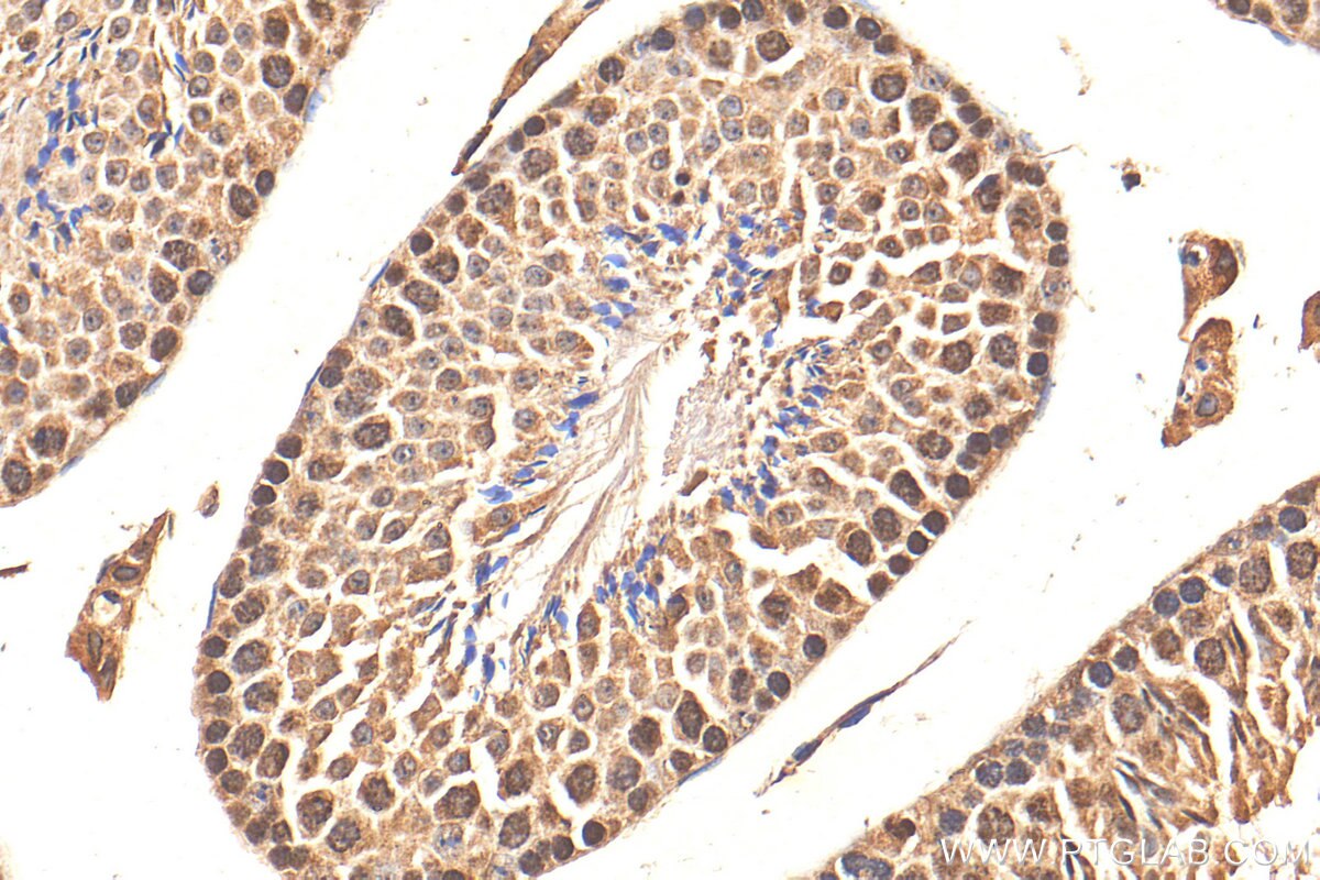 Immunohistochemistry (IHC) staining of mouse testis tissue using CTDSPL2 Polyclonal antibody (17532-1-AP)