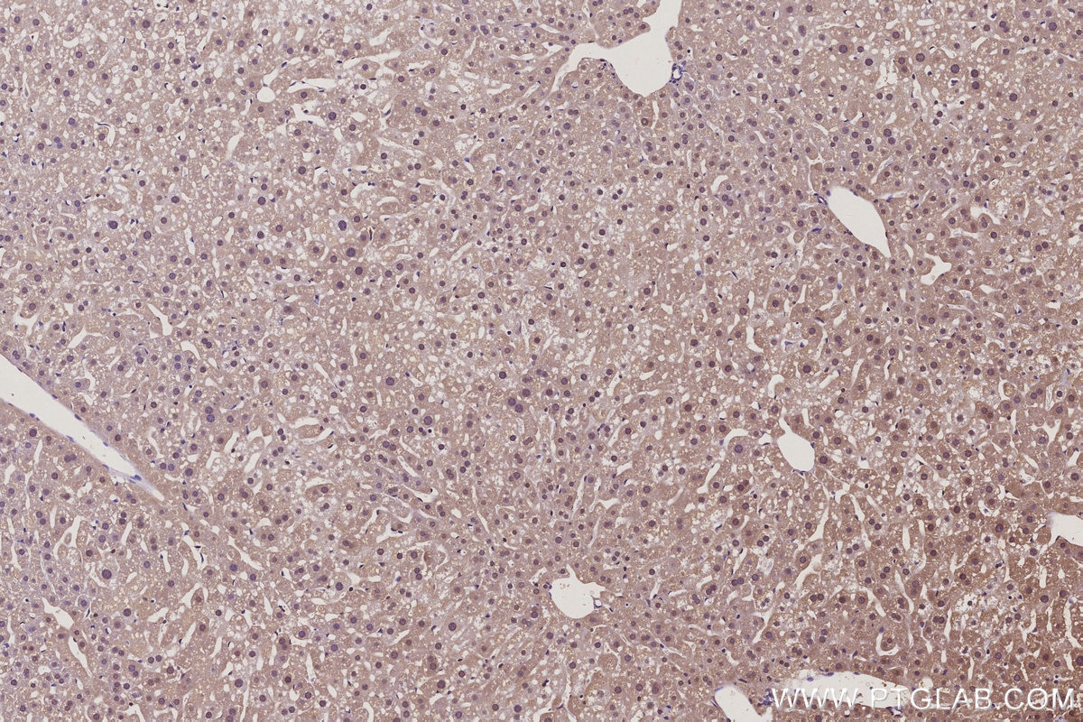 Immunohistochemistry (IHC) staining of mouse liver tissue using CTDSPL2 Polyclonal antibody (17532-1-AP)