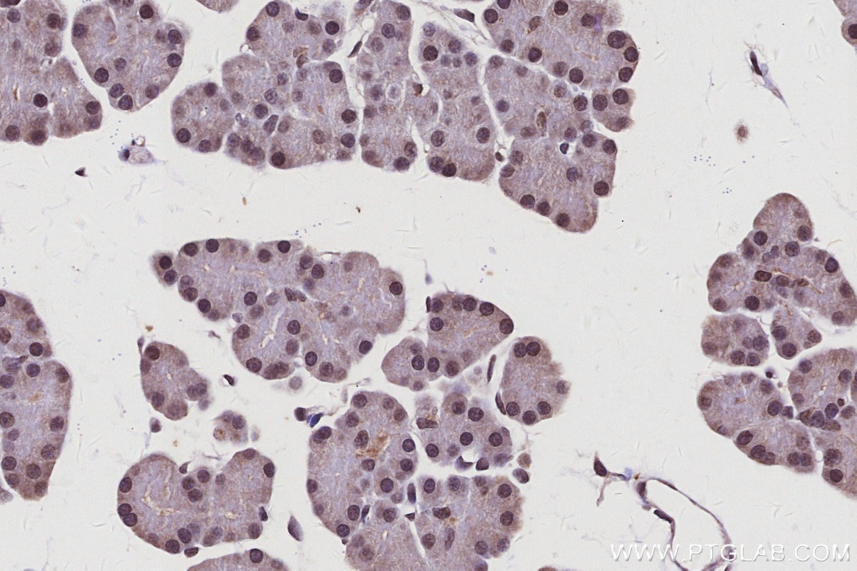 Immunohistochemistry (IHC) staining of rat pancreas tissue using CTDSPL2 Polyclonal antibody (17532-1-AP)