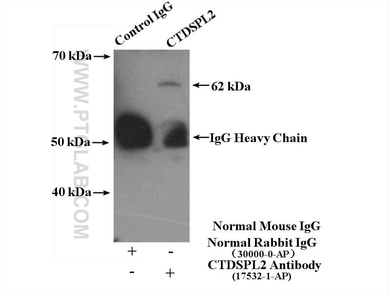Immunoprecipitation (IP) experiment of mouse testis tissue using CTDSPL2 Polyclonal antibody (17532-1-AP)