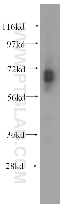 Western Blot (WB) analysis of human brain tissue using CTDSPL2 Polyclonal antibody (17532-1-AP)