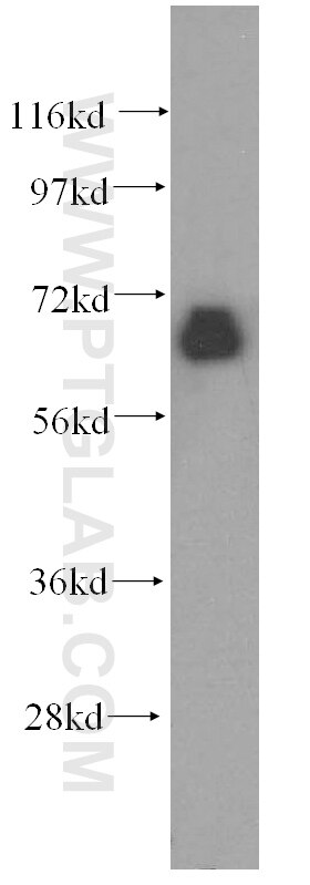 Western Blot (WB) analysis of HeLa cells using CTDSPL2 Polyclonal antibody (17532-1-AP)