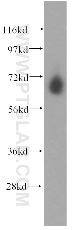 Western Blot (WB) analysis of HepG2 cells using CTDSPL2 Polyclonal antibody (17532-1-AP)