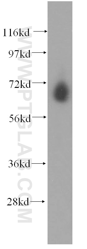 WB analysis of HepG2 using 17532-1-AP