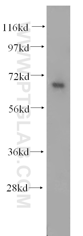 Western Blot (WB) analysis of Y79 cells using CTDSPL2 Polyclonal antibody (17532-1-AP)