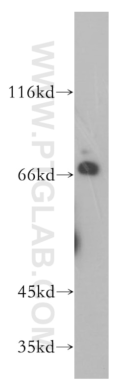 Western Blot (WB) analysis of HeLa cells using CTDSPL2 Polyclonal antibody (17532-1-AP)